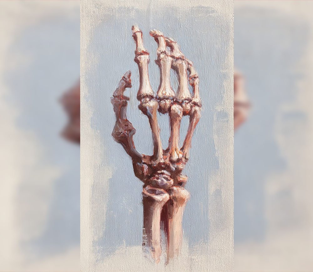 CARPAL TUNNEL SYNDROME: SAAT SARAF MEDIAN “BERTERIAK MINTA TOLONG”